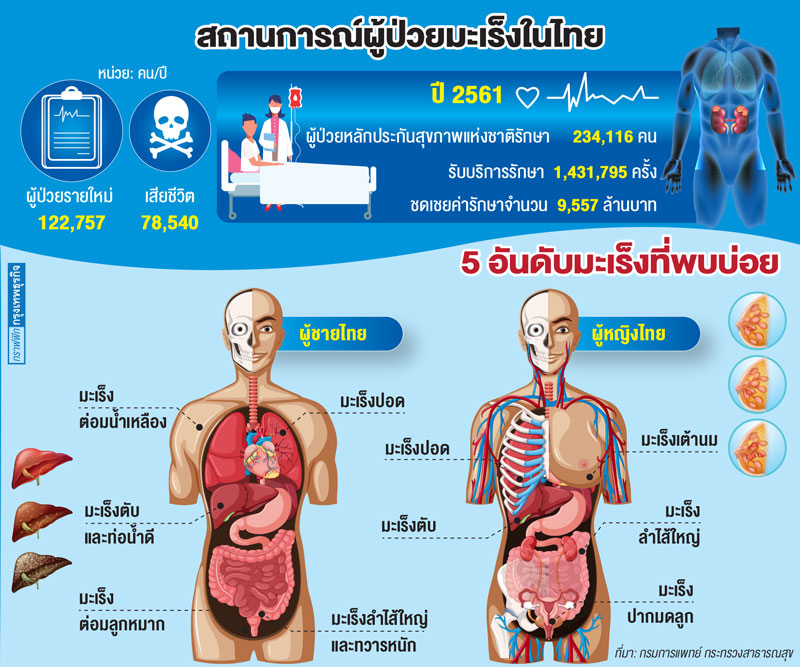 'มะเร็ง' สาเหตุคนไทยตายอันดับ 1
